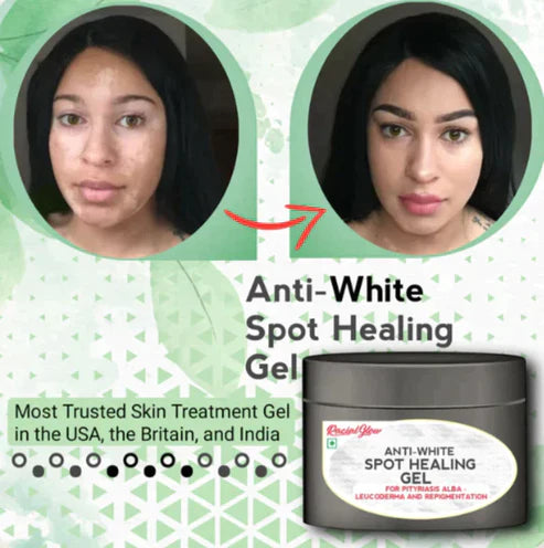 Anti-White Spot Healing Gel (50gm)